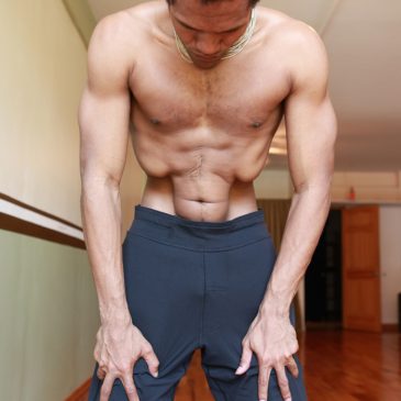 Tiesiųjų pilvo raumenų atskyrimas (nauli)